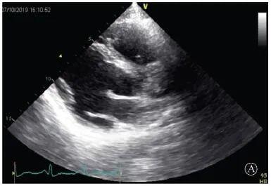 【惊人】基因检测解决心血管疾病诊断和治疗疑难