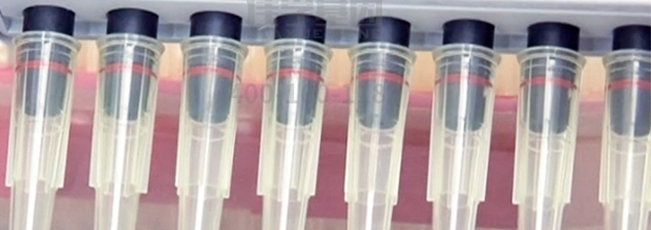 【佳学基因检测】爆发力基因解码、基因检测