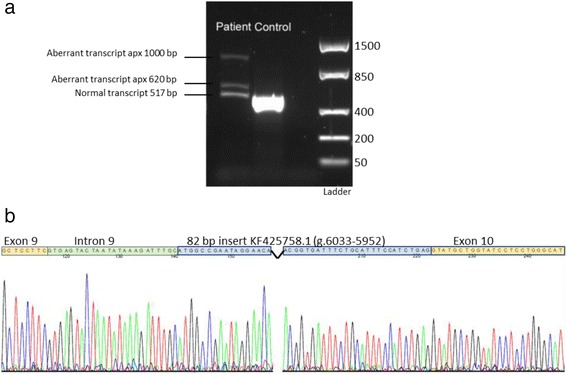 【佳学基因检测】NANA贮积病基因检测