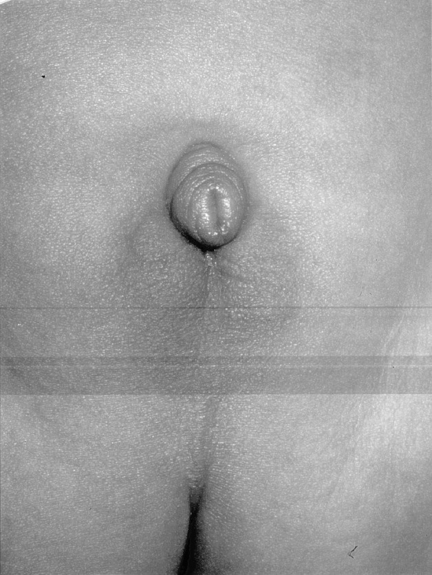 【佳学基因检测】男性生殖科分子病理检测资质考核中关于CTPS1的问题及答案