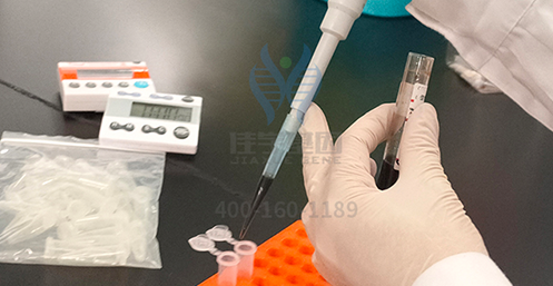 【佳学基因解码-基因检测】英国王室秃顶基因太强大,帅气的威廉王子也中招 【佳学基因解码-基因检测】英国王室秃顶基因太强大,帅气的威廉王子也中招