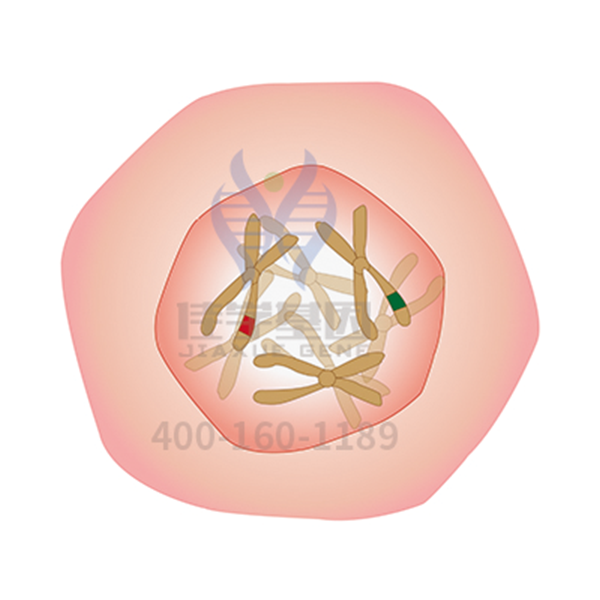 【佳学基因解码-基因检测】一种类肿瘤的肺部疾病——特发性肺纤维化 【佳学基因解码-基因检测】一种类肿瘤的肺部疾病——特发性肺纤维化